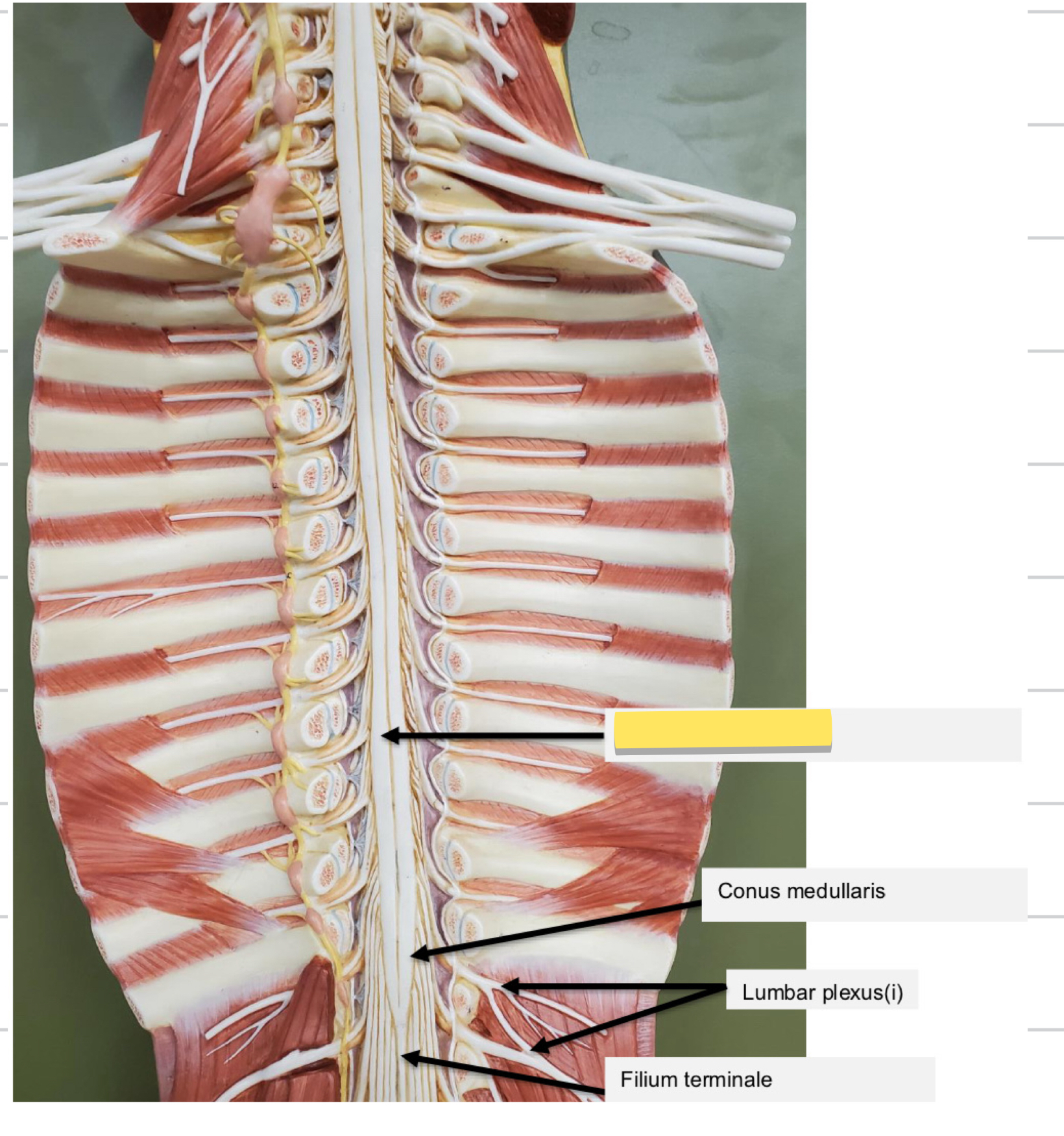 <p>Name this part</p>