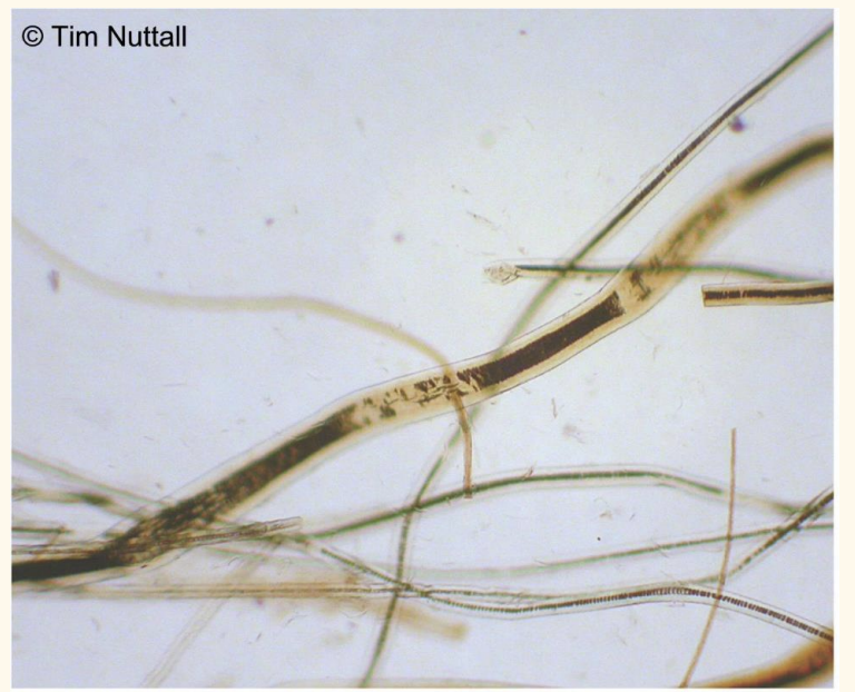 <p>What has happened to these hair shafts?</p>