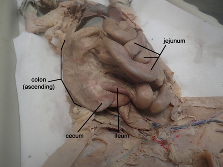 <p>end of ascending colon</p>
