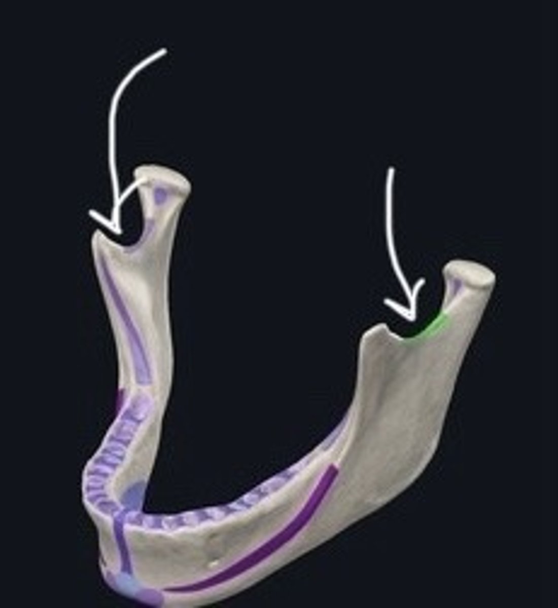 <p>Indentation between the condylar and coronoid processes.</p>