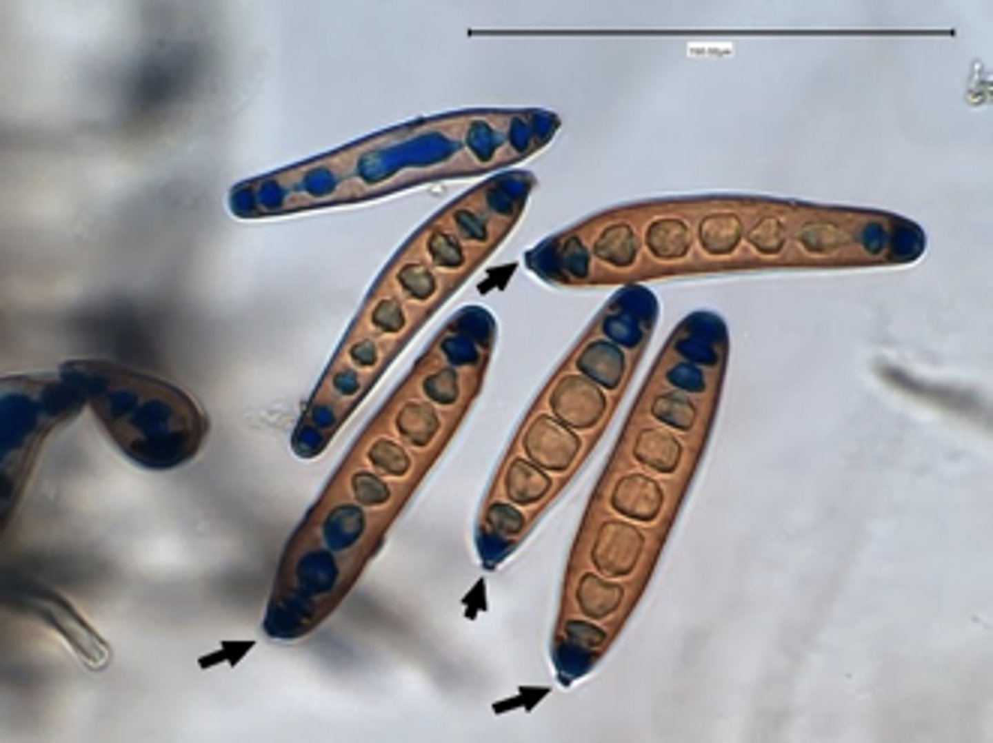 <p>2-3 days; rapid</p><p>Light gray, wooly, becomes gray-black</p><p>Reverse: black</p><p>Microscopic: septate hyphae with long cylindrical poroconidia with 6-14 cells. has a scar on the conidium</p><p>Conditions: Fungal sinusitis</p>