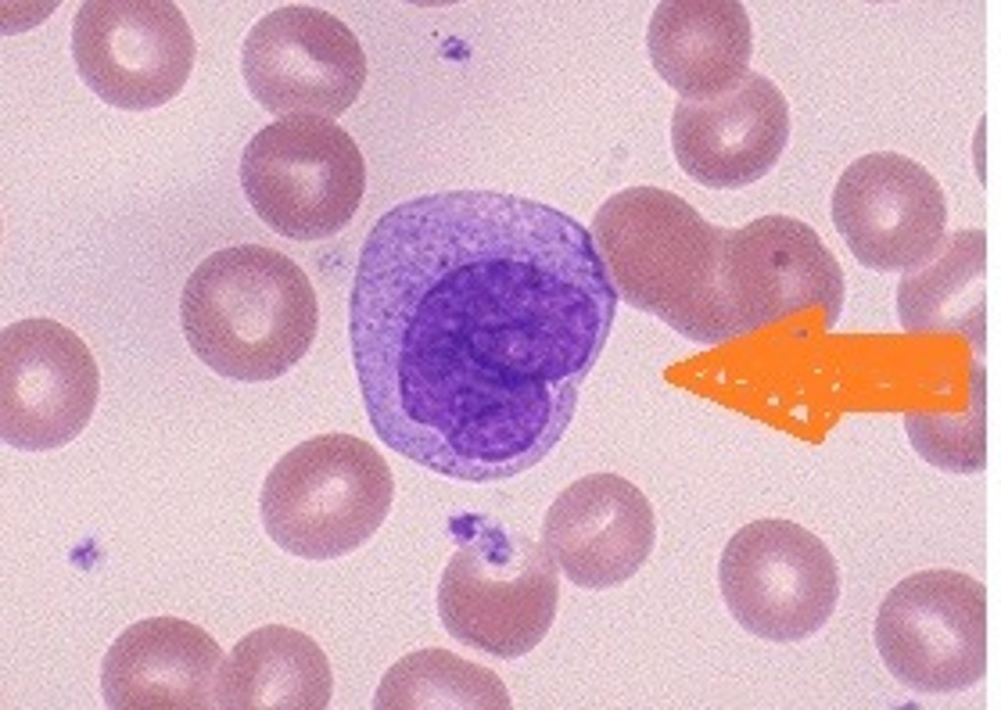 <p>Name the leukocyte.</p>