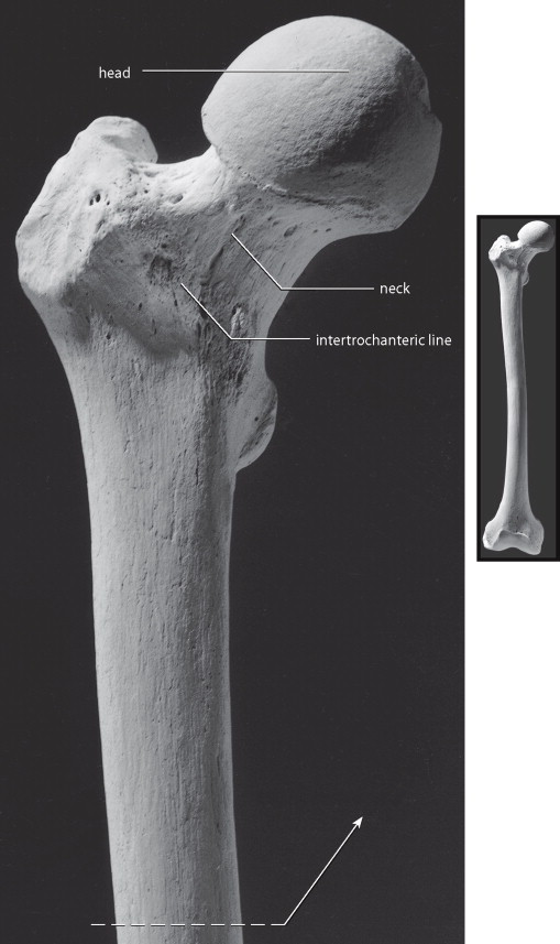 <p>rounded proximal joint surface, margin varies in sharpness. is sharpest most inferiorly and smoothest anteriorly</p>