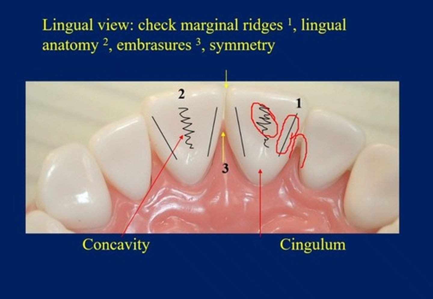 <p>check marginal ridges, lingual anatomy, embrasures, symmetry</p>