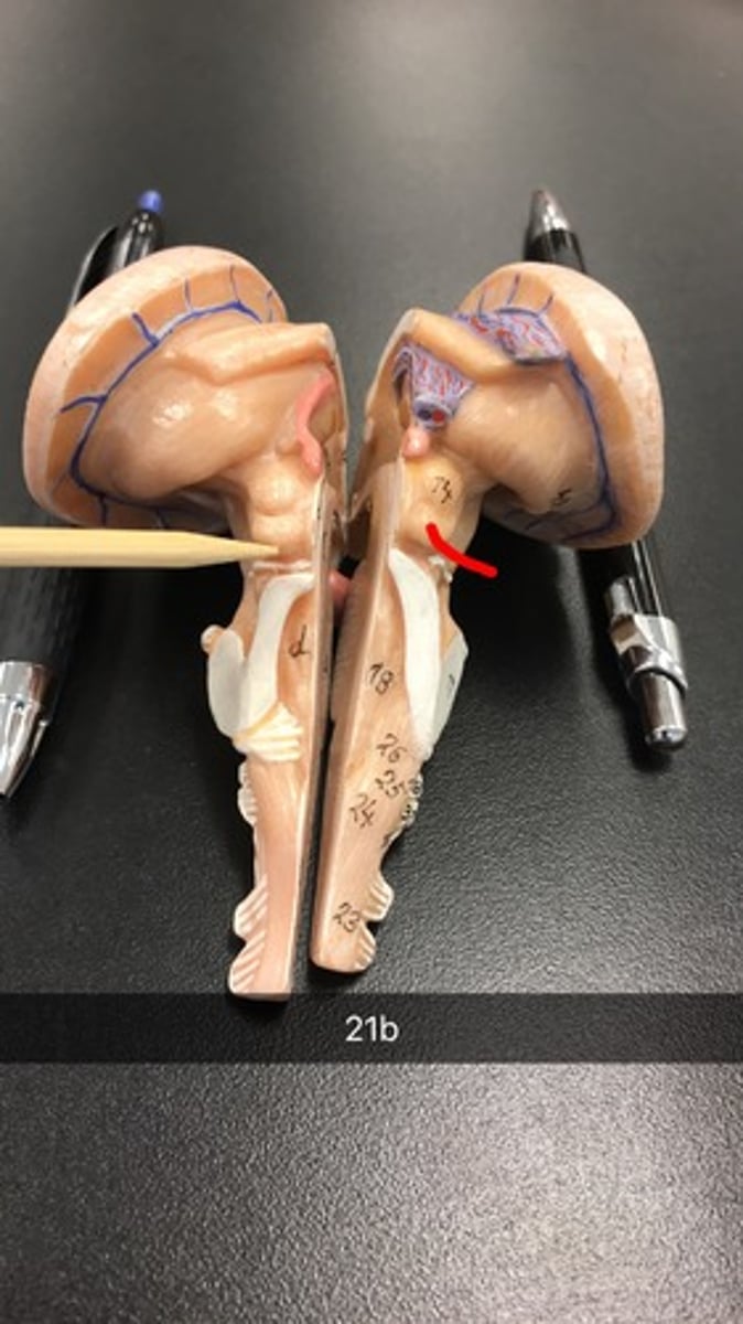 <p>bottom 2 bumps</p>