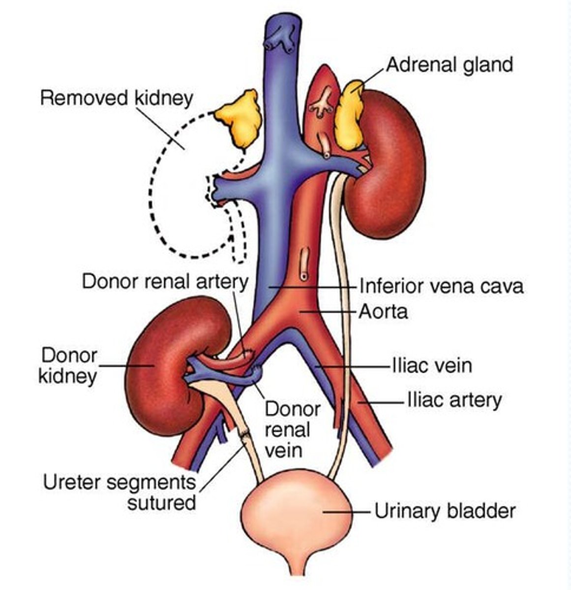 <p>A treatment that uses the peritoneum as a membrane to remove waste products and excess fluid.</p>