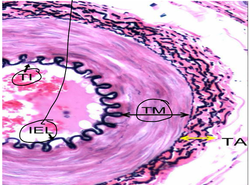 <p>It is a membran ethat marks the boundary between the tunica intima and tunica media (better distinguished in arteries)</p>