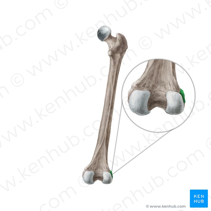 <p>Femur: Bone Location</p>