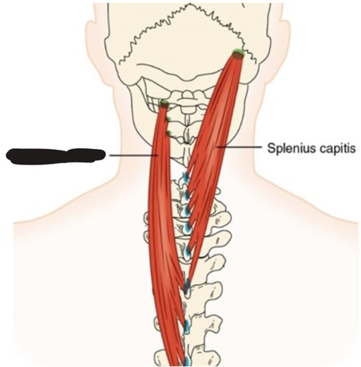 <p>What muscle is this?</p>