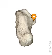 <p>Bony shelf extending from the medial side of the Calcaneous bone.</p>
