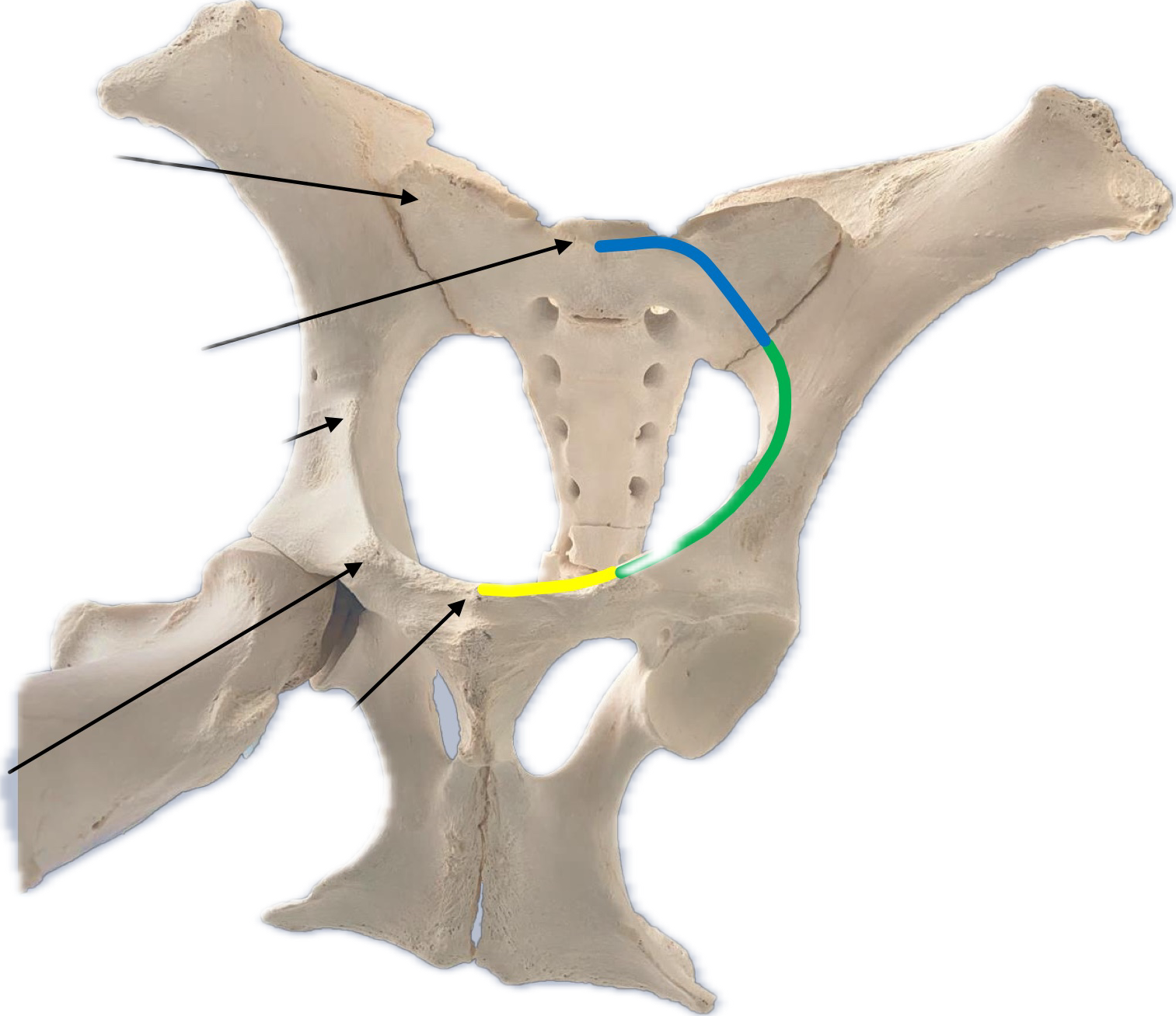 <p>what is the yellow</p>