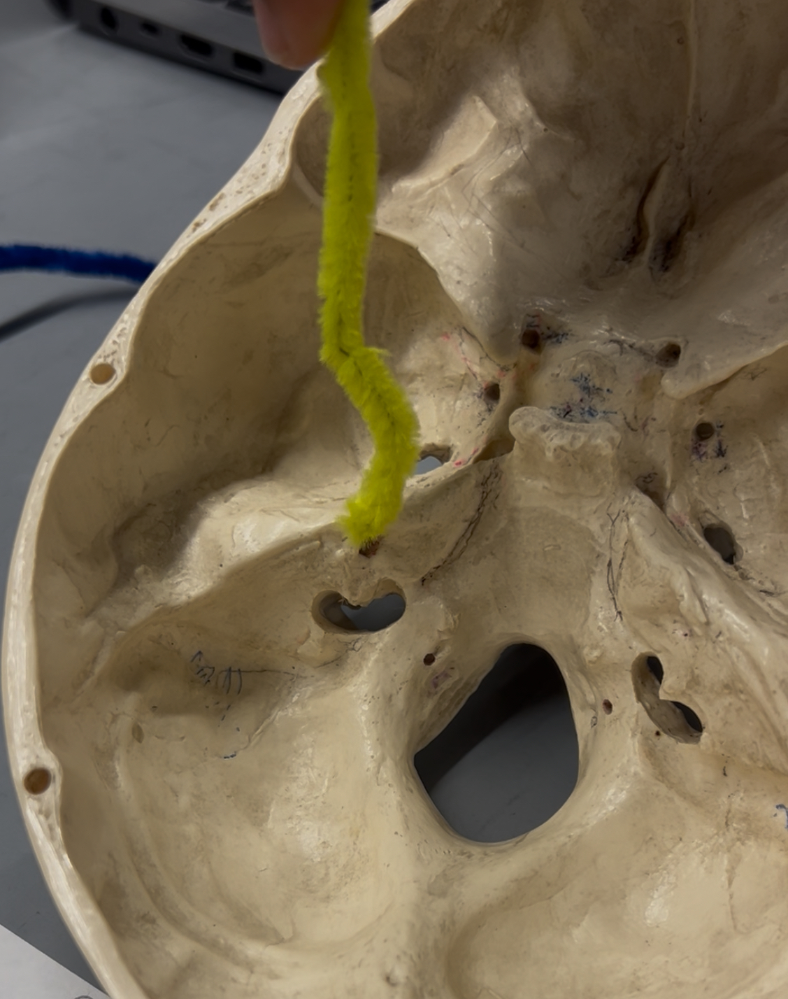 <p>What foramina is labeled by the yellow pipe? What bones are they located? Also, which if any cranial nerves pass through there?</p>