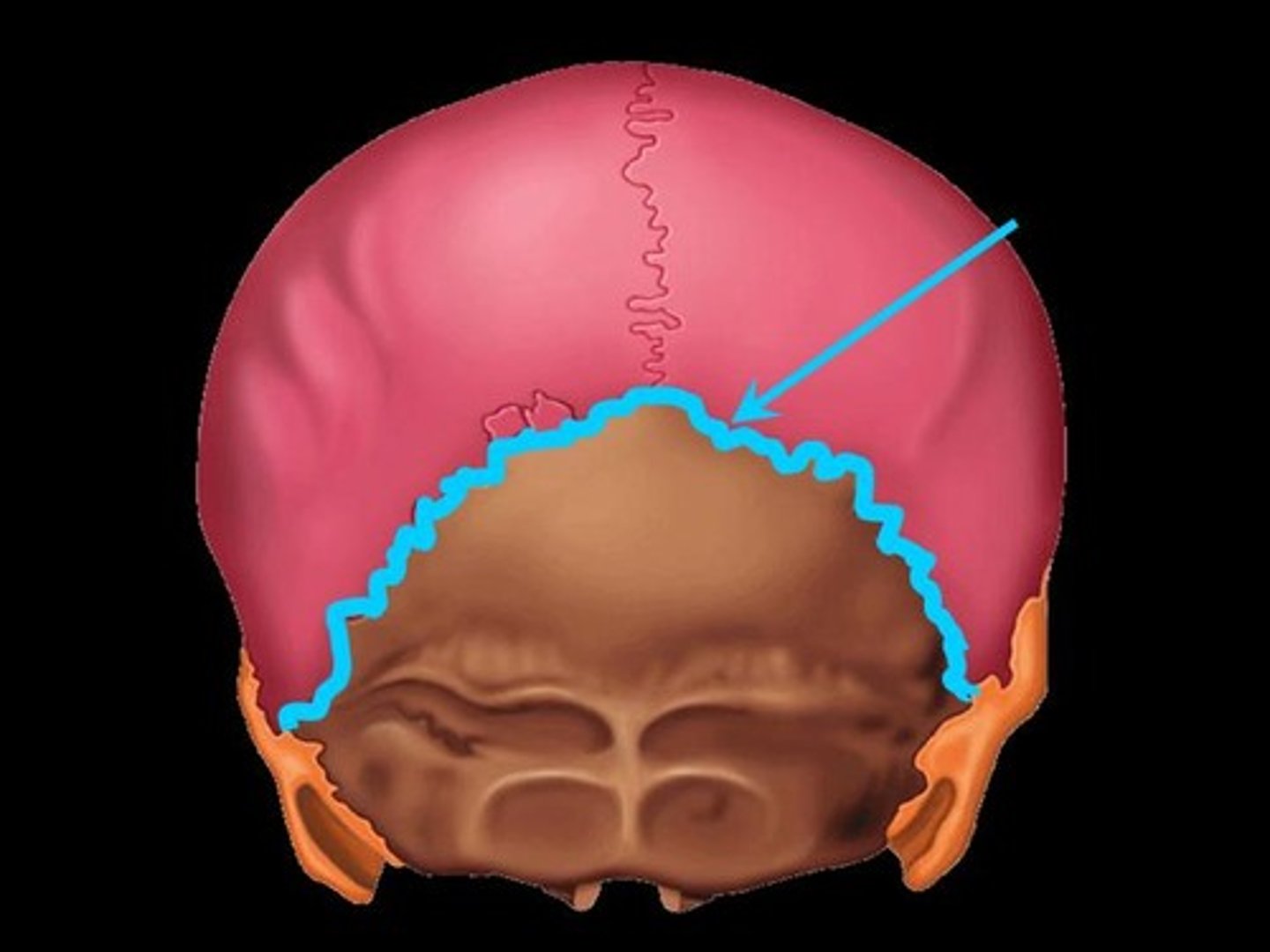 <p>between the parietal and occipital bones</p>