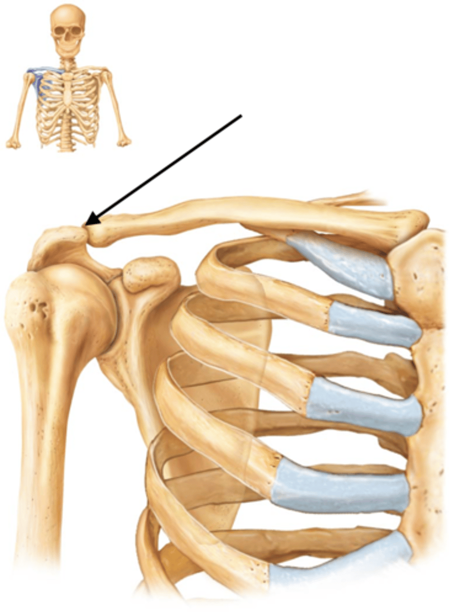 <p>Gliding joint.</p>
