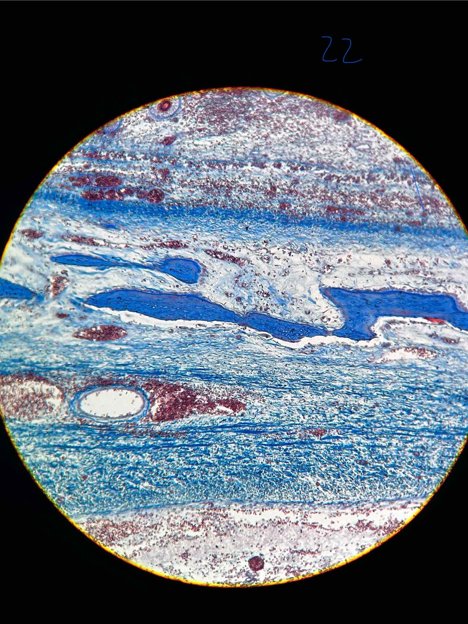 term image