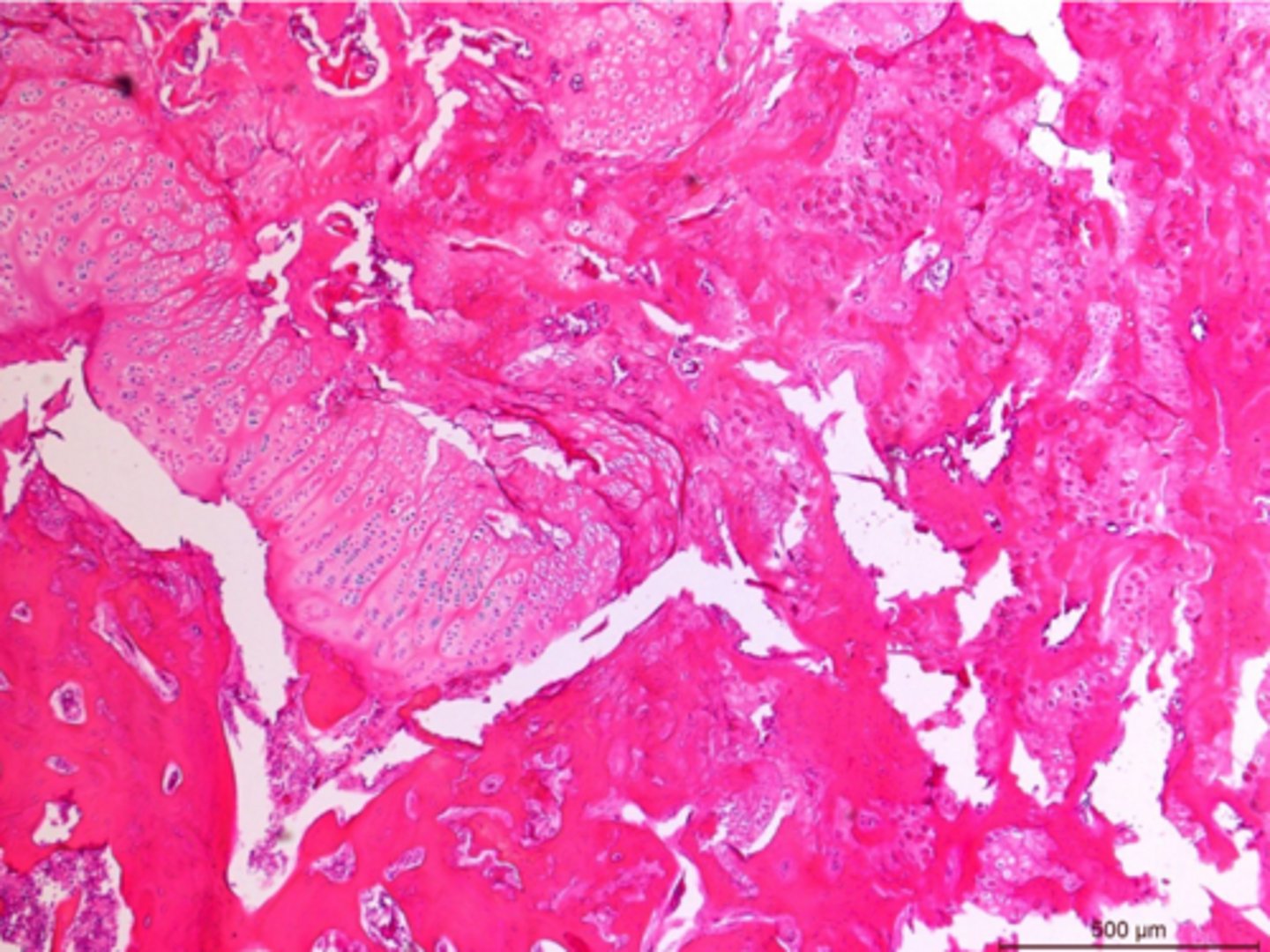 <p>Identify the pathology:</p>