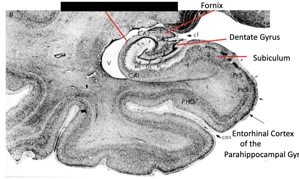 <p><strong>limbic system</strong></p><ul><li><p>what structure is this?</p></li></ul><p></p>