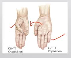 <p>reposition </p>