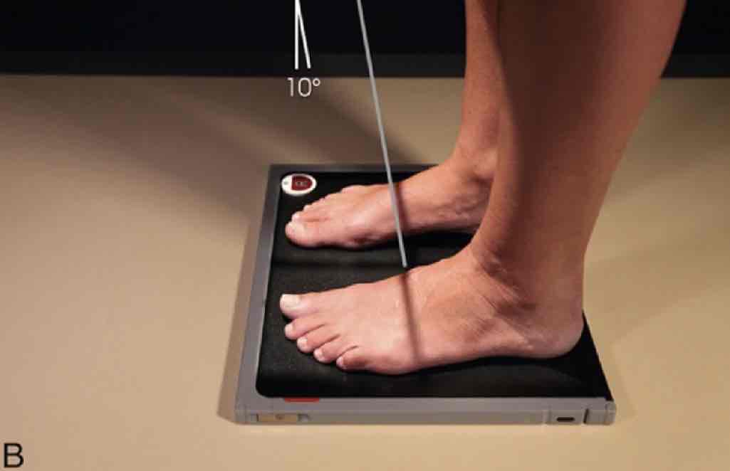 <p>What Projection is this?</p>