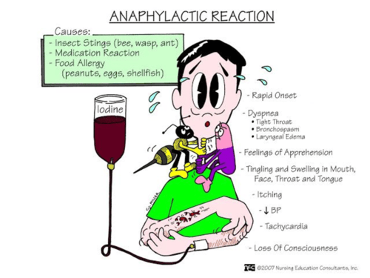 <p>Treatment</p><p>- Epipen (epinephrine): Bronchodilation, increase in BP</p><p>- Benadryl</p><p>- Glucocorticosteroids</p><p>Second exposure is much worse</p>