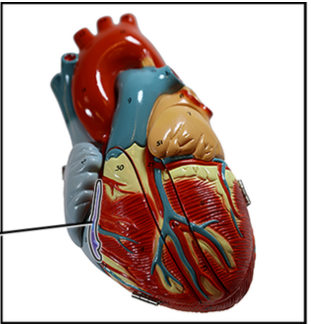 <p><span style="color: rgb(0, 0, 0);">Name this structure of the heart.</span></p>