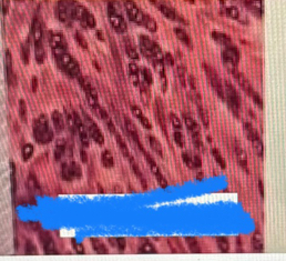 <p>What tissue is this?</p>