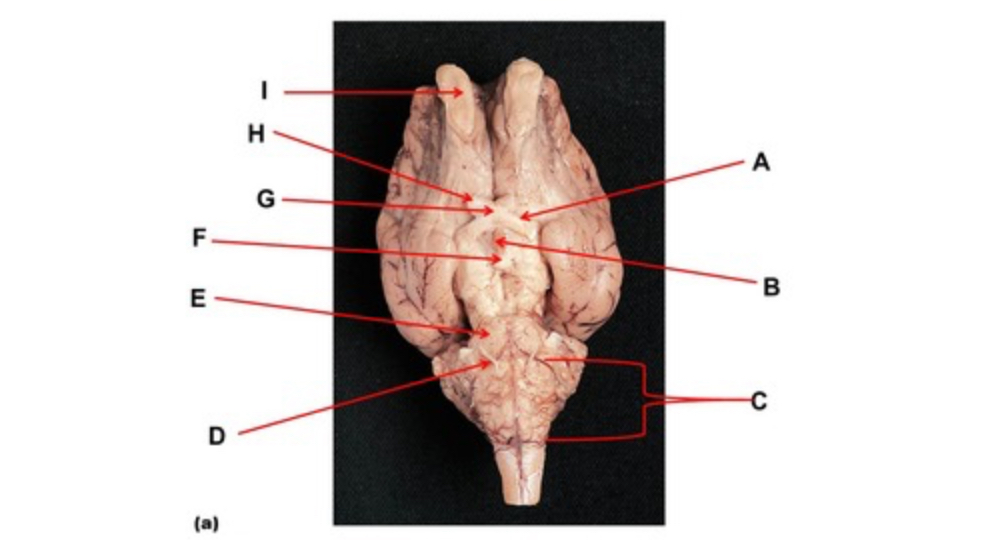 <p>Name the nerve at the tip of arrow H. </p>