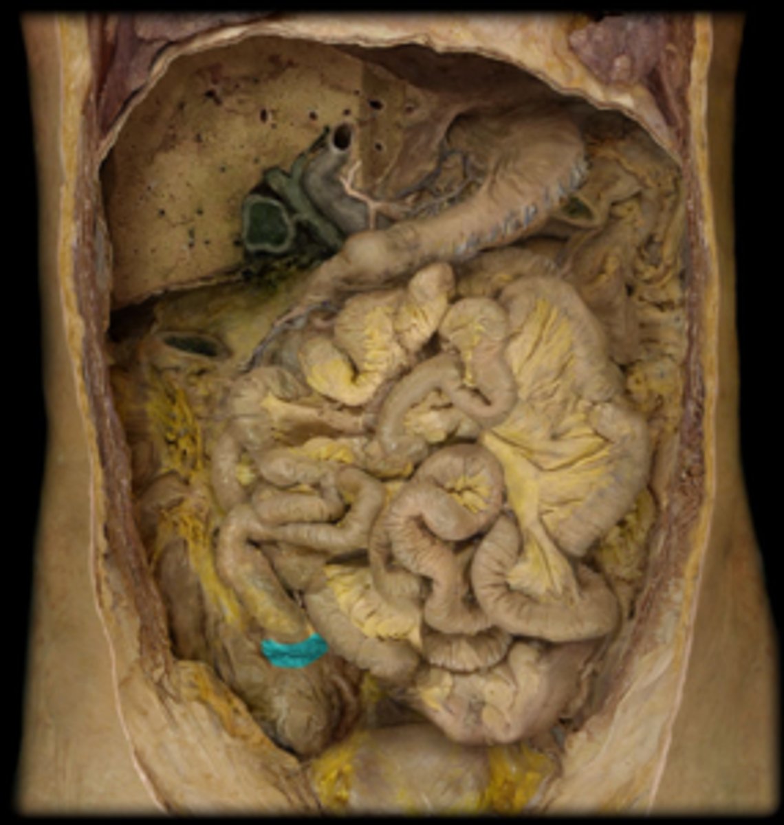 <p>Name the ring of smooth muscle found at this location.</p>