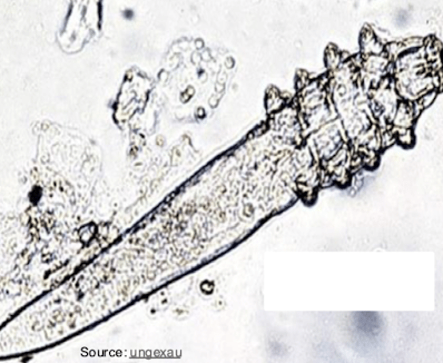 <p>what type of mite is shown?</p>