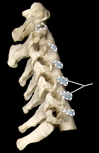 <p>What are the highlighted portions called?</p><p>What region of the vertebral column is this?</p>