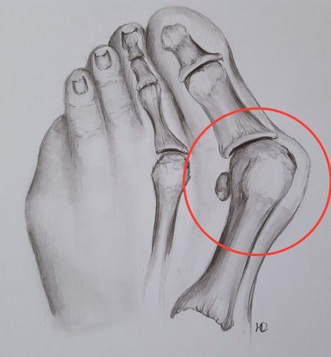 <p>Big toe</p>
