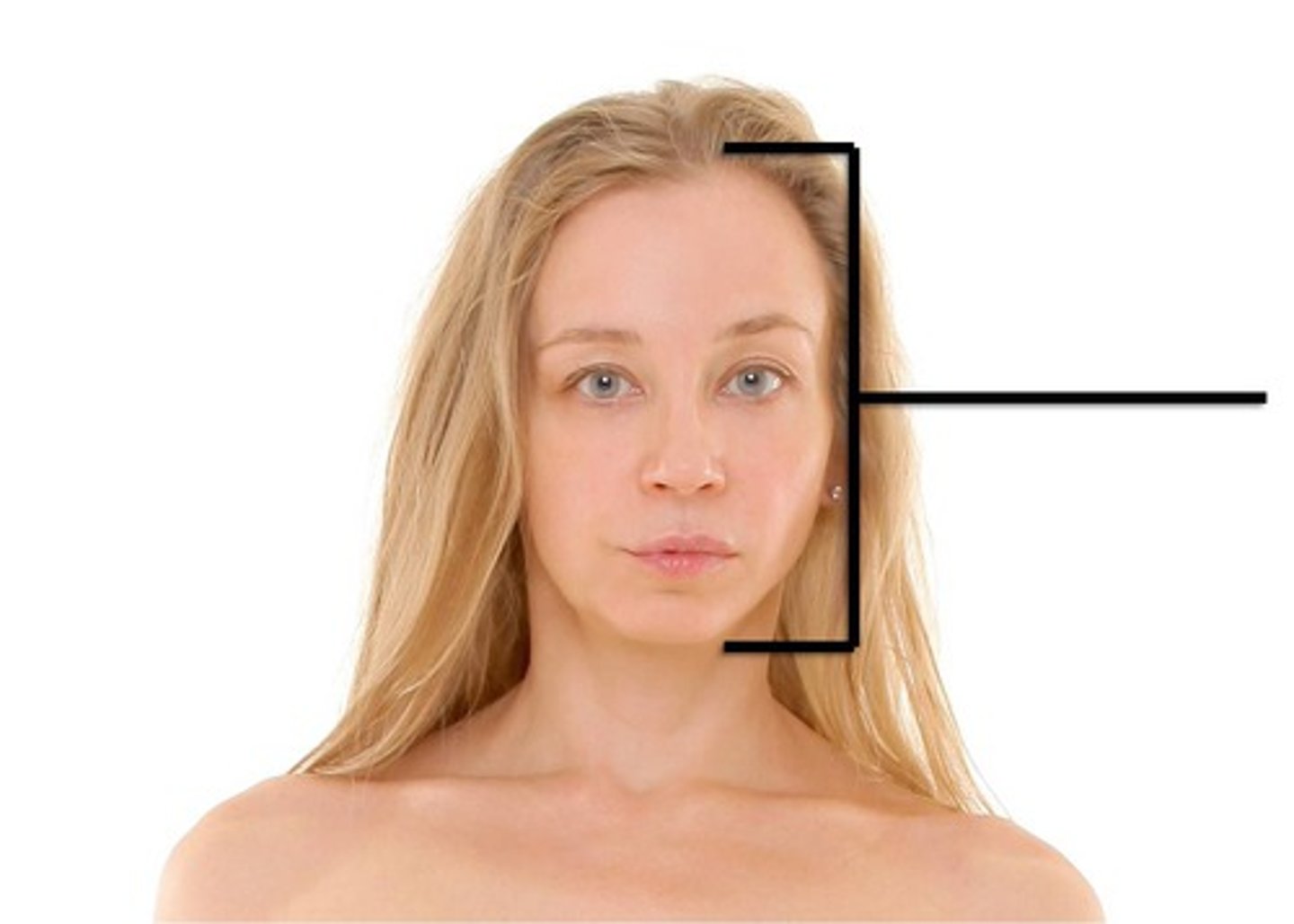 <p>Cephalic region</p>