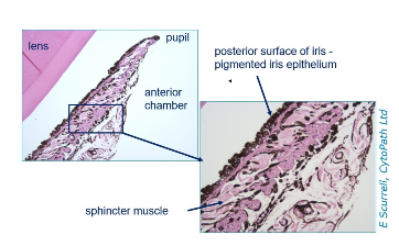 <p>Iris - uveal tract</p><p></p>