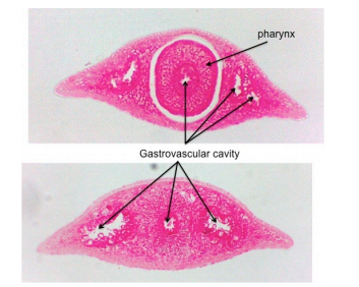 <p>What structure is being pointed to? (connective tissue between every organ)</p>