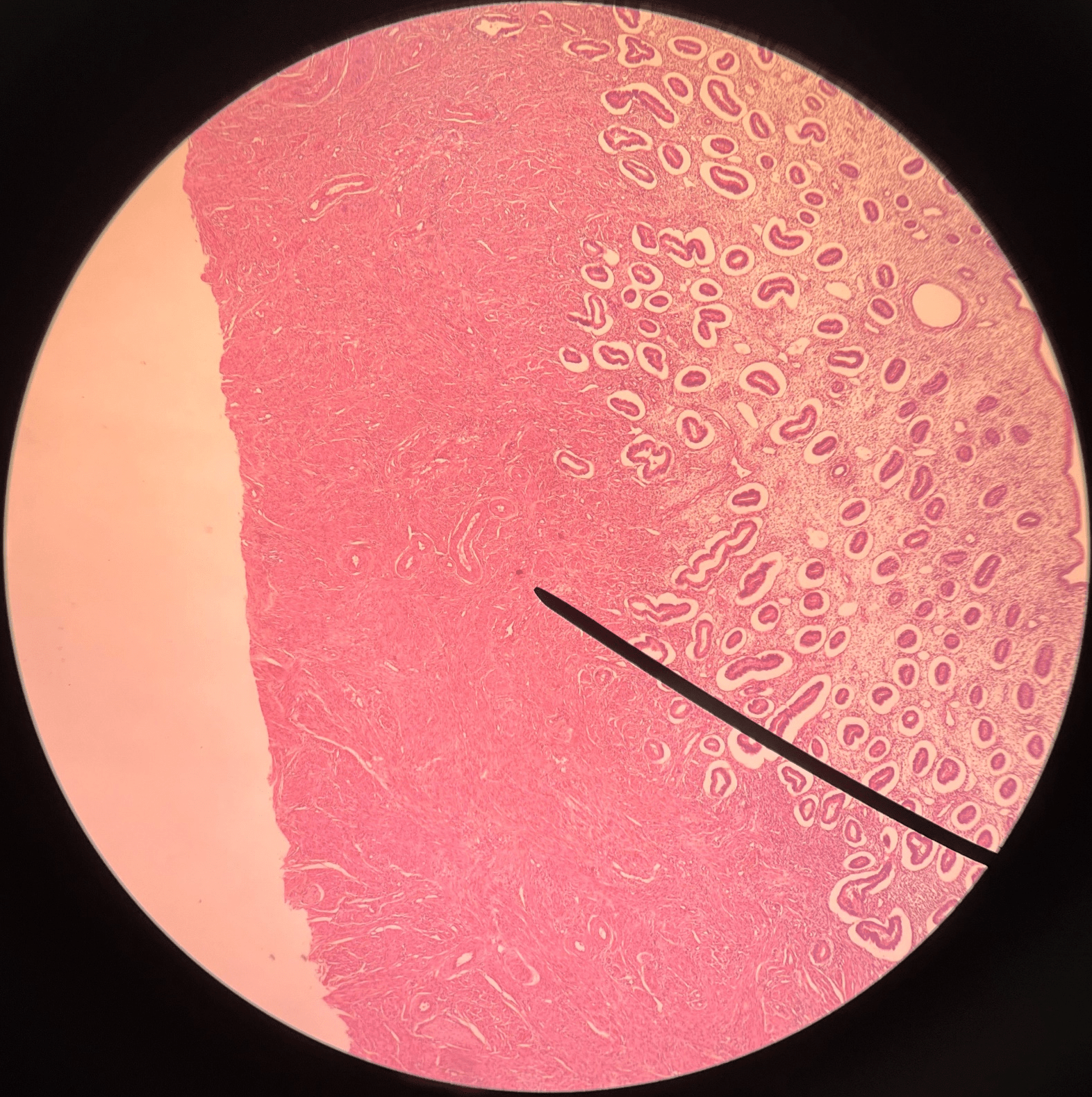 • Slide histology of the uterus during its proliferation (follicular) phase.

• The thick layer composed of smooth muscle.

• External to the endometrium.
