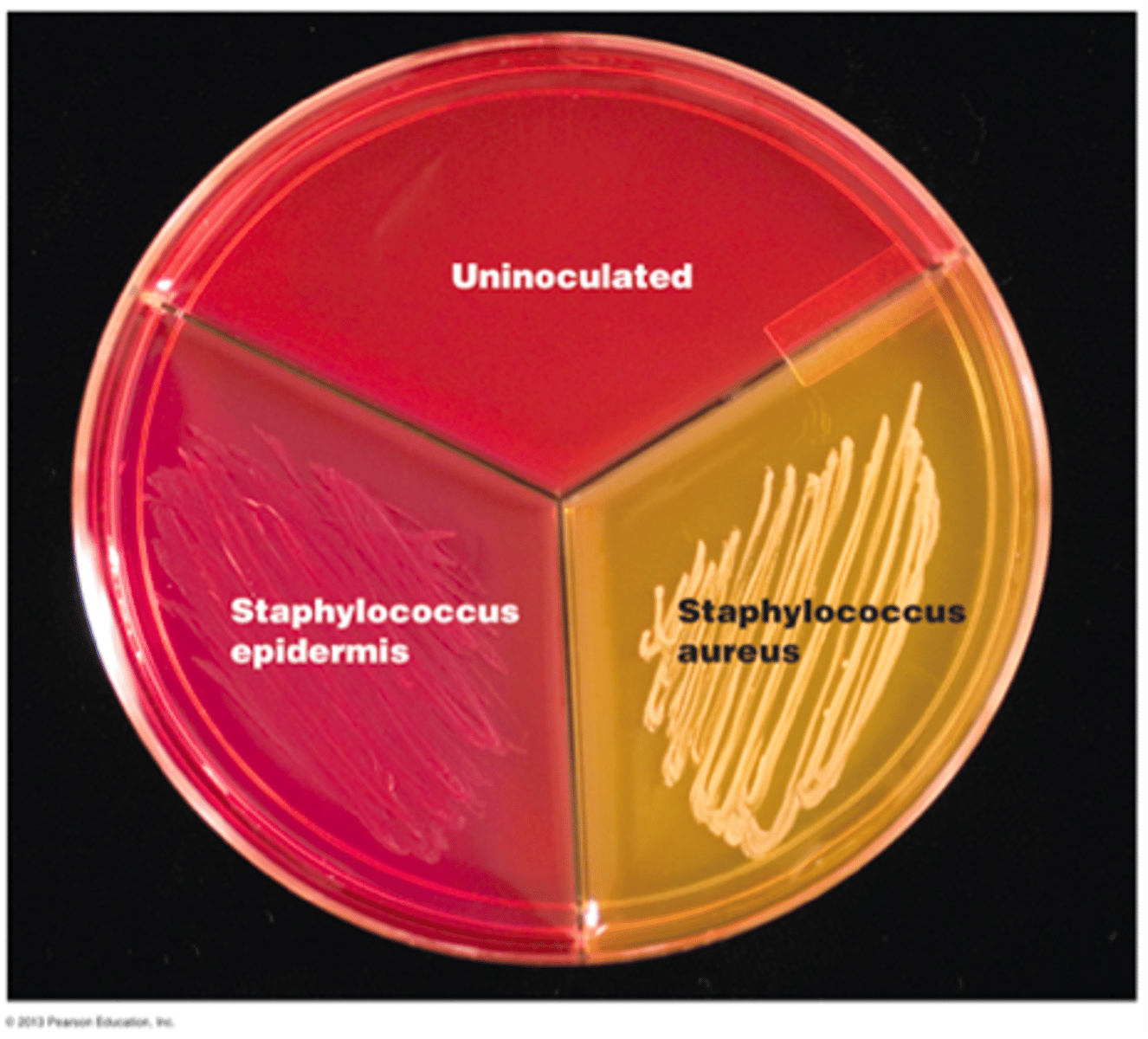 <p>What are the expected results of Staph epidermis streaking on an MSA plate?</p>