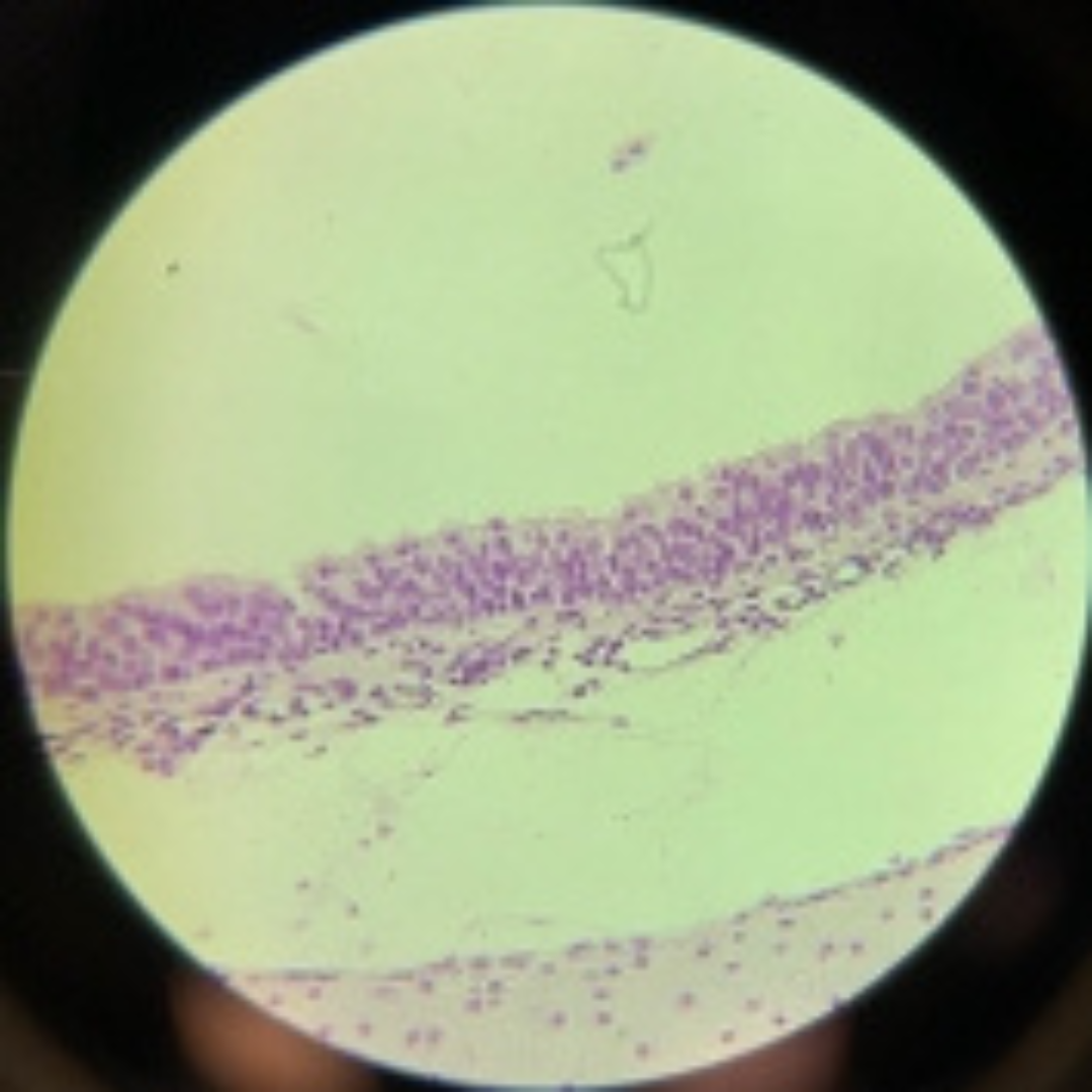term image