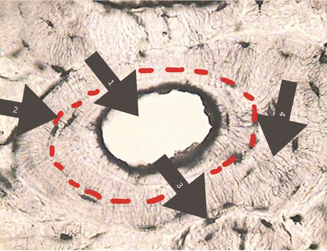 <p>Name the Parts of the Bone </p>