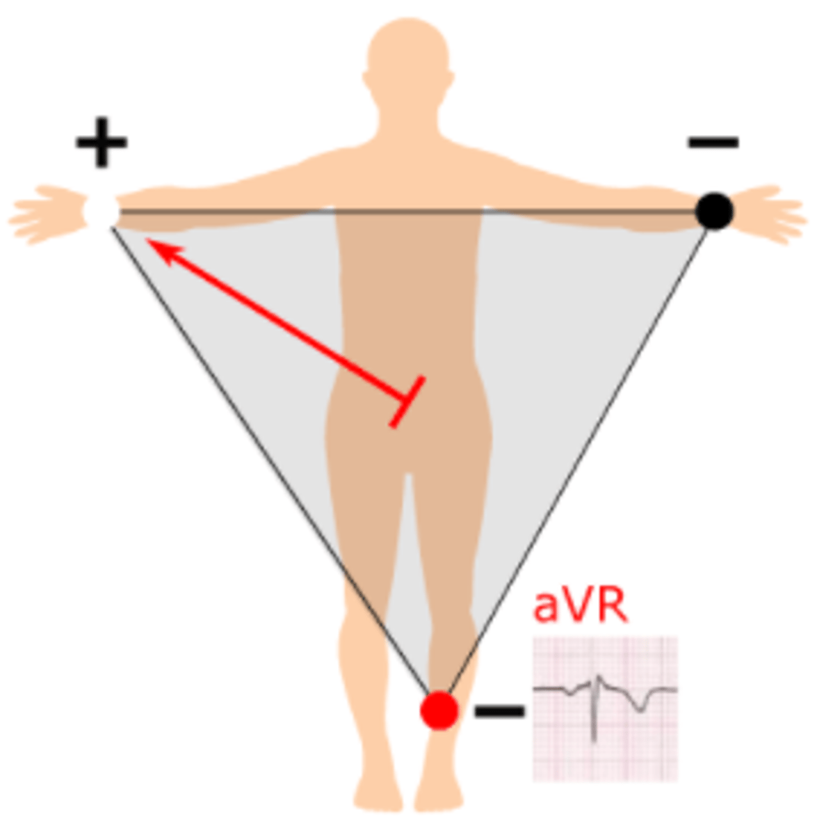 <p>From halfway between the left arm and left leg to the right arm, with the positive electrode being at the right arm at -150°</p>