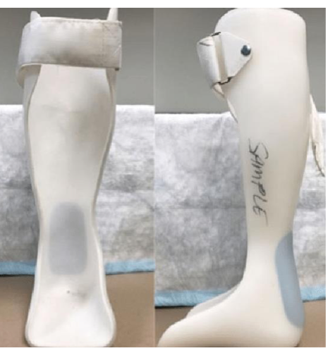 <p>what is the name, type, and purpose of this ankle orthotic?</p>