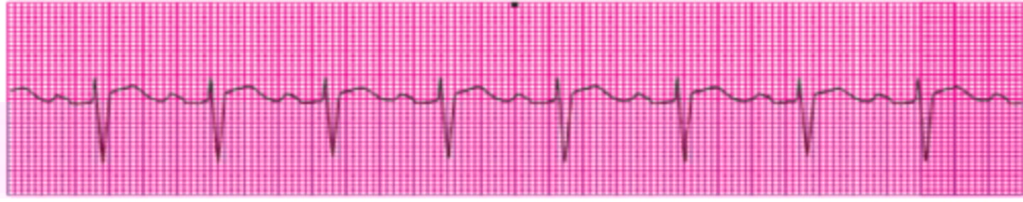 <p>Name this rhythm.</p>