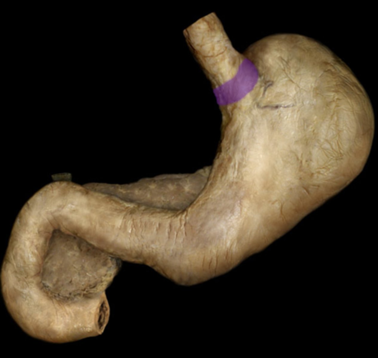 knowt flashcard image