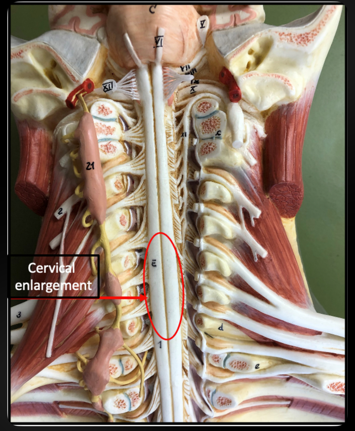 <p>Cervical Enlargement</p>