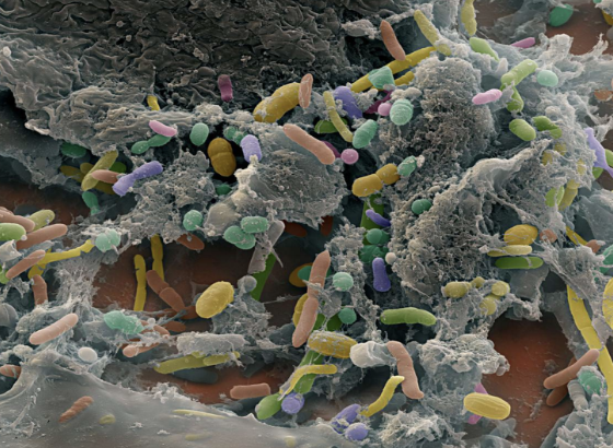 <ul><li><p>completes absorption of water</p></li><li><p>formation, storage, and explusion of feces</p></li><li><p>contains&nbsp;“normal flora” (bacteria)</p></li><li><p>manufacture vitamins</p></li><li><p>fat soluble A, D, E, K</p></li></ul><p></p>