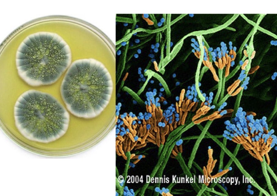 <p>Genus: Penicillium</p>