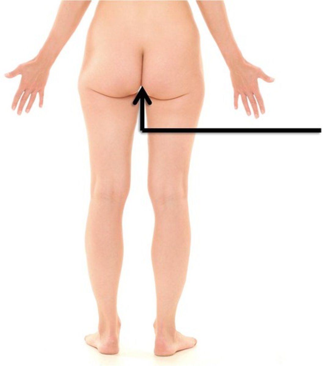 <p>diamond-shaped area between legs, from the pubic arch to the anus</p>