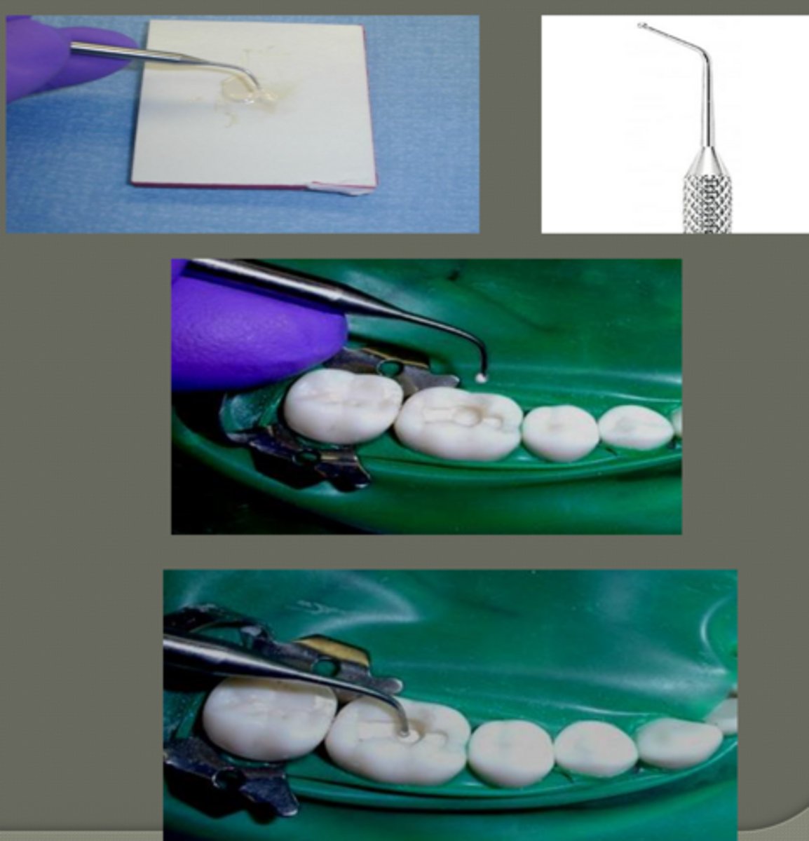 <p>small amount of mixed past on the ball tip of placing instrument</p><p>place only in deep portion of cavity prep.:</p><p>- pulpal floor</p><p>- axial wall</p><p>thin layer (on dentin closest to pulp)</p>