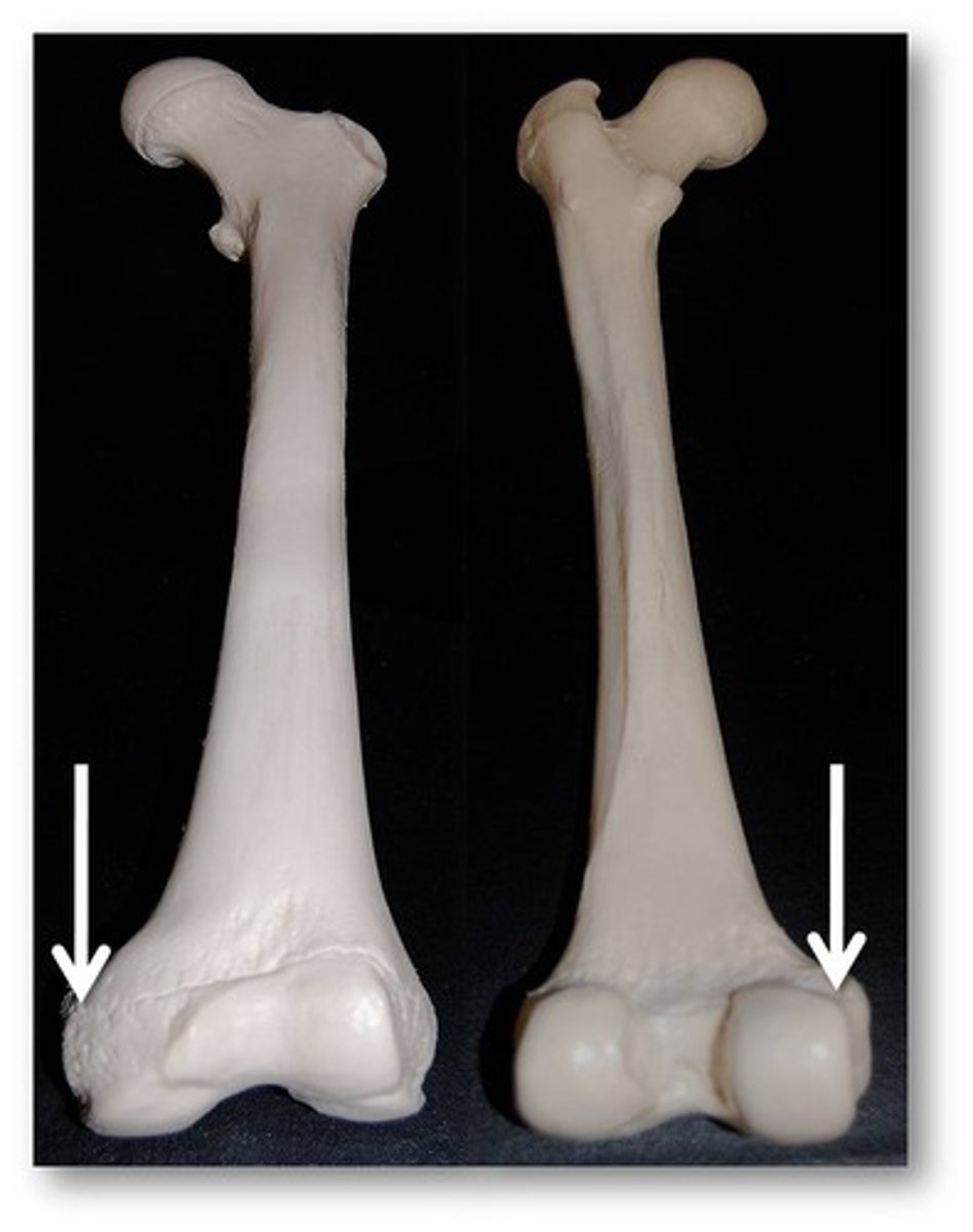 <p>Name this specific part of the femur.</p>