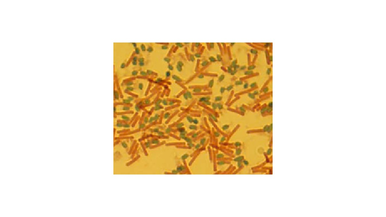 <p>l<span>ooking at the micrograph, does the bacteria Clostridium difficile produce spores</span></p>