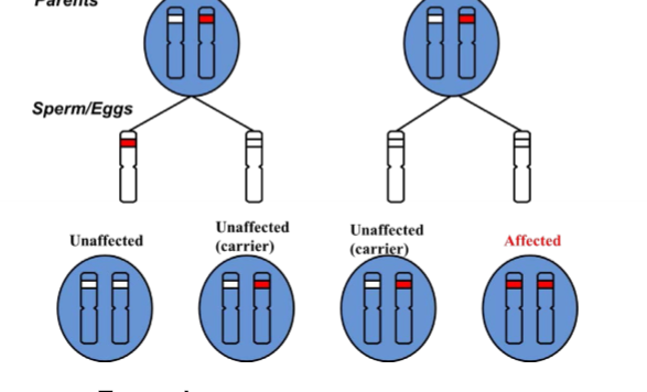 <p>sickle cell disease, cystic fibrosis, congenital deafness, phenylketonuria, spinal muscular atrophy, recessive blindness</p>